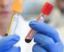 Sa Integrative Health - Comprehensive Blood Panel